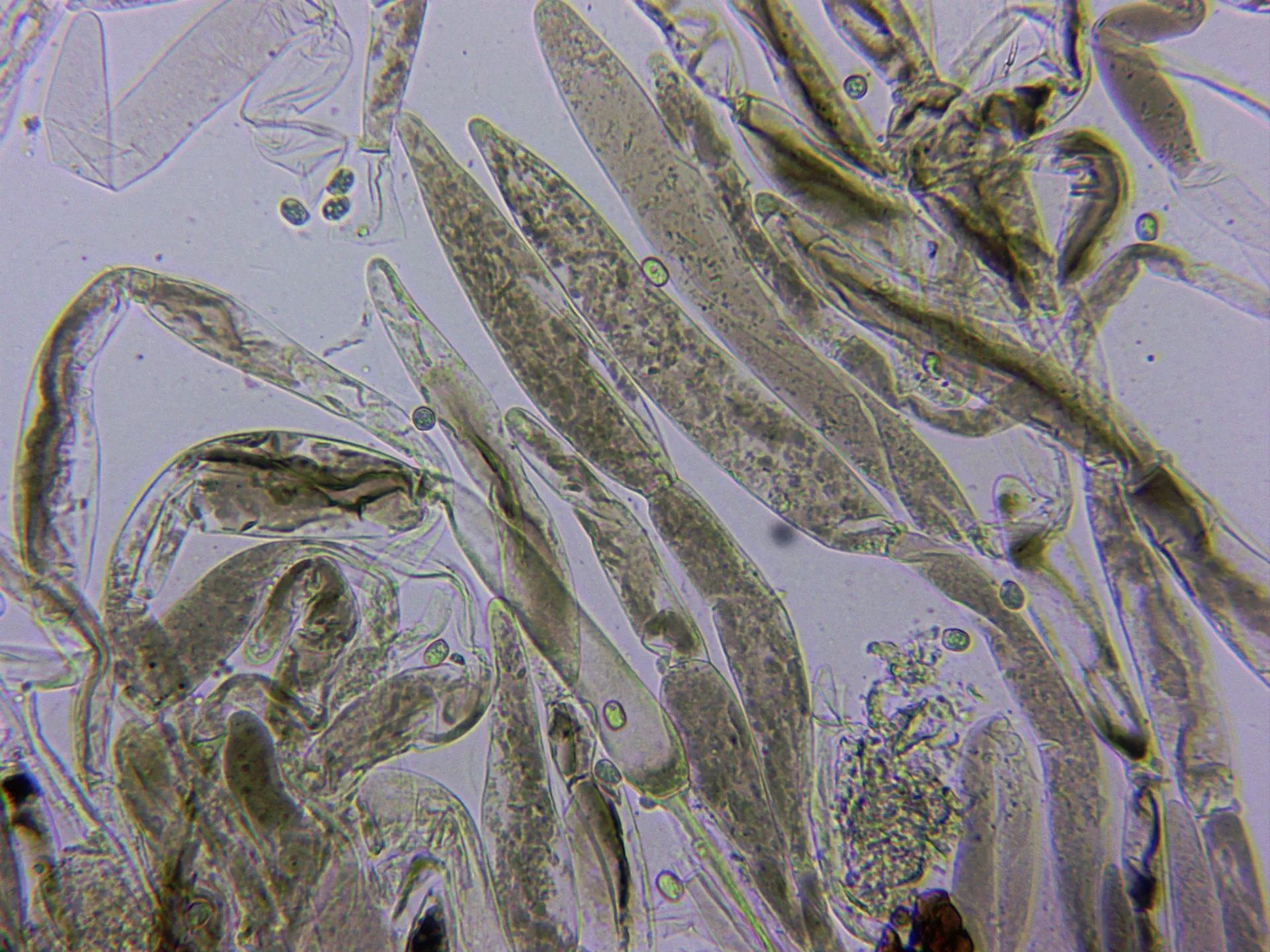 Microscopía de Pluteus atromarginatus - 10 - Suprapellis x 400 agua